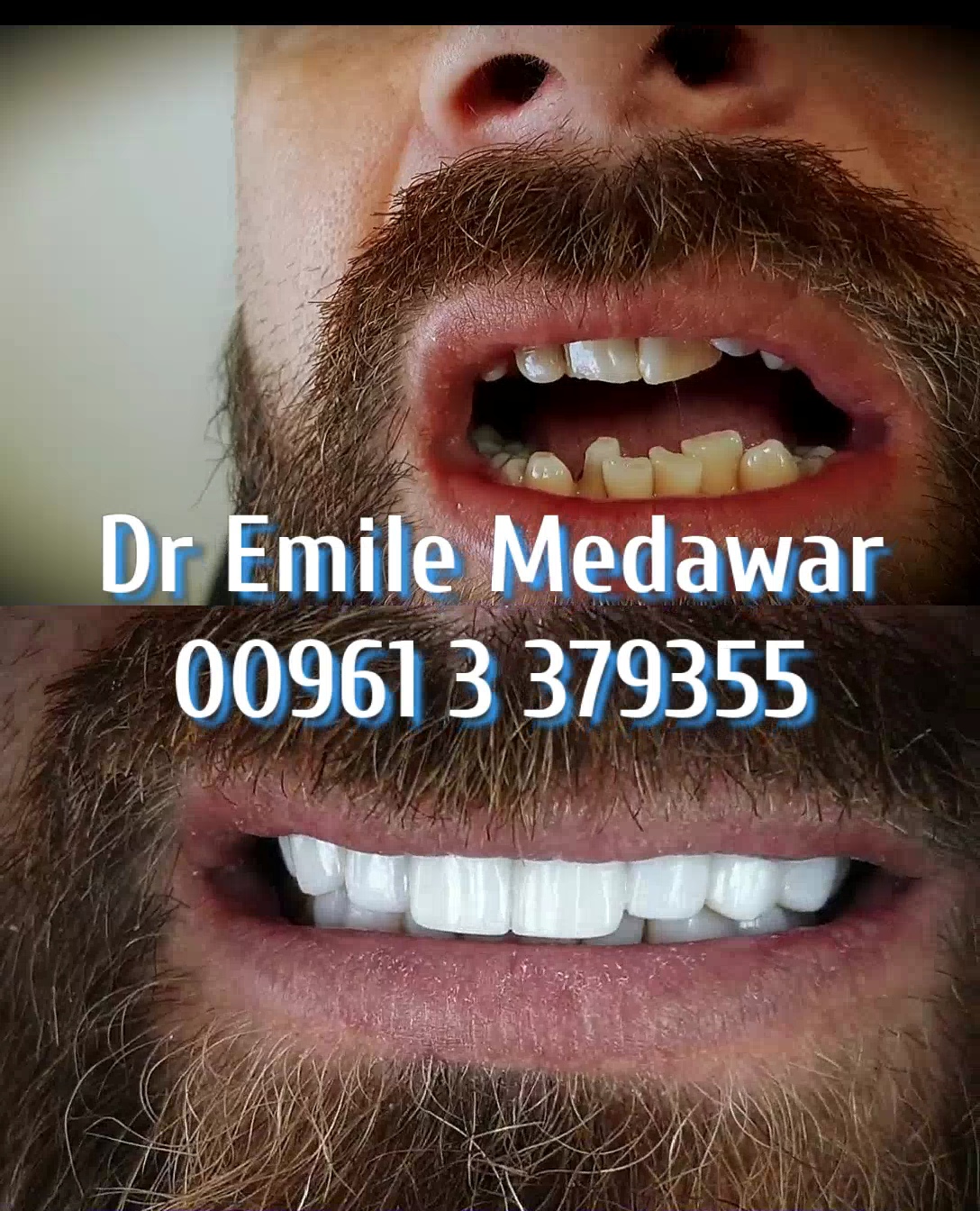 hollywood smile in lebanon beirut