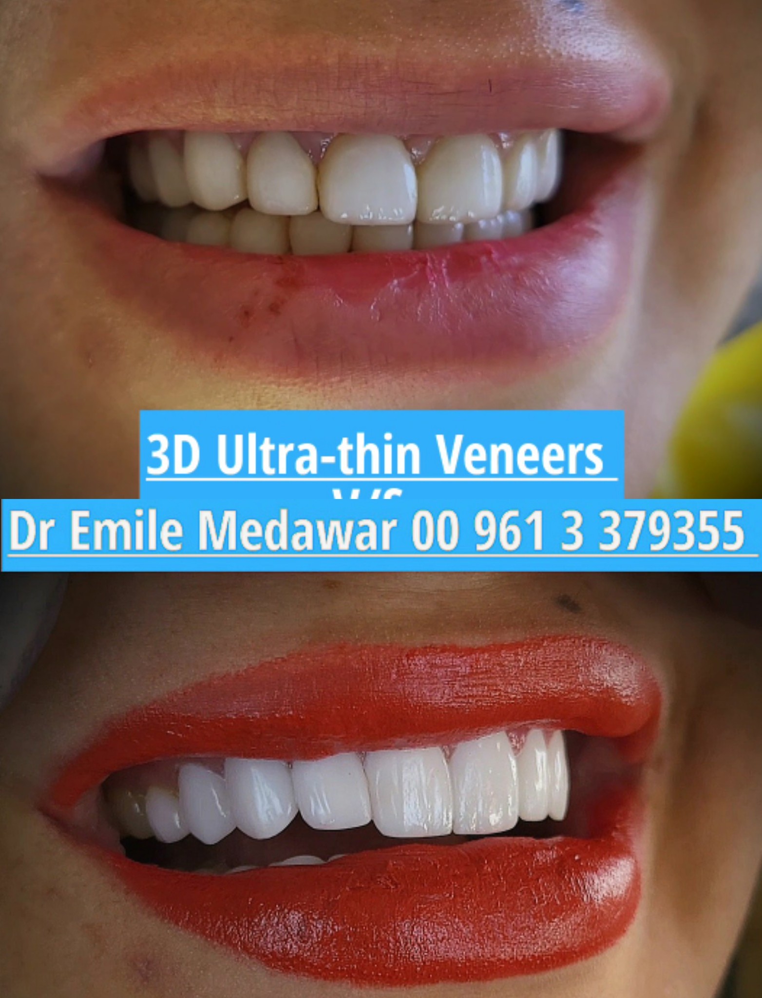 Dentist in lebanon beirut